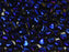 Herzperlen 6 mm Schwarz Voll Azuro Tschechisches Glas Farbe_Black Farbe_ Blue